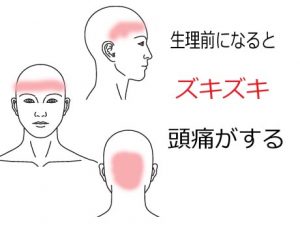 生理痛の症例 北海道札幌市東区の亮鍼灸院