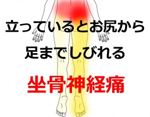 坐骨神経痛 腰痛の症例 北海道札幌市東区の亮鍼灸院